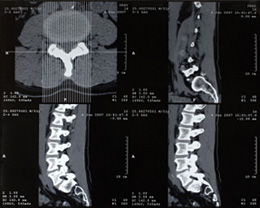 MRT-Röntgenbild